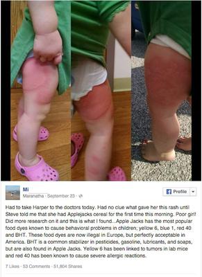 Apple Jacks cause a rash?